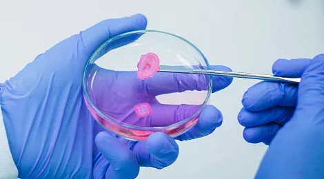 3d-bioprinting