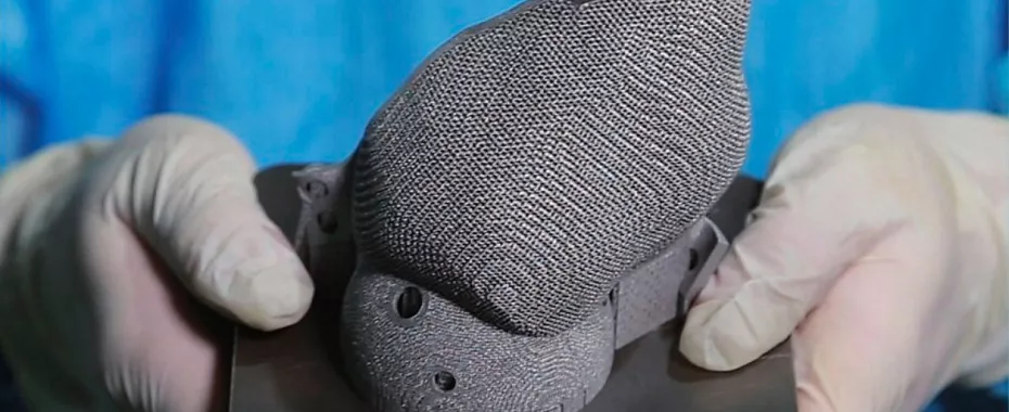 hbd-orthopedic-metal-3d-printing