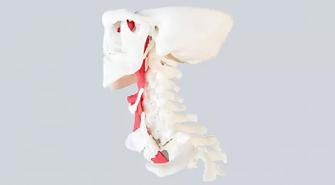 protofab-spine-and-windpipe-case