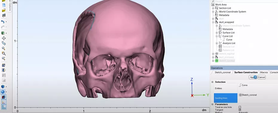 materialise-mimics-implant-tavr