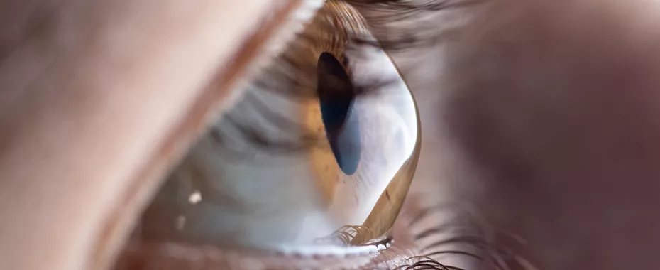 materialise-mimics-eye-nanoscale