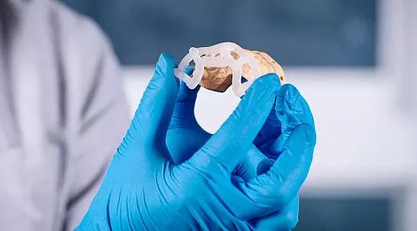 3d-printing-dentistry