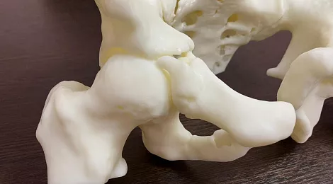 3d-printing-medicine