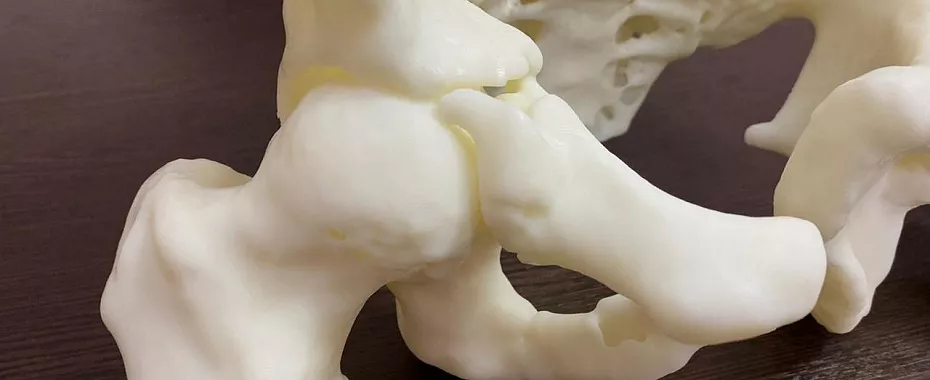 3d-printing-medicine