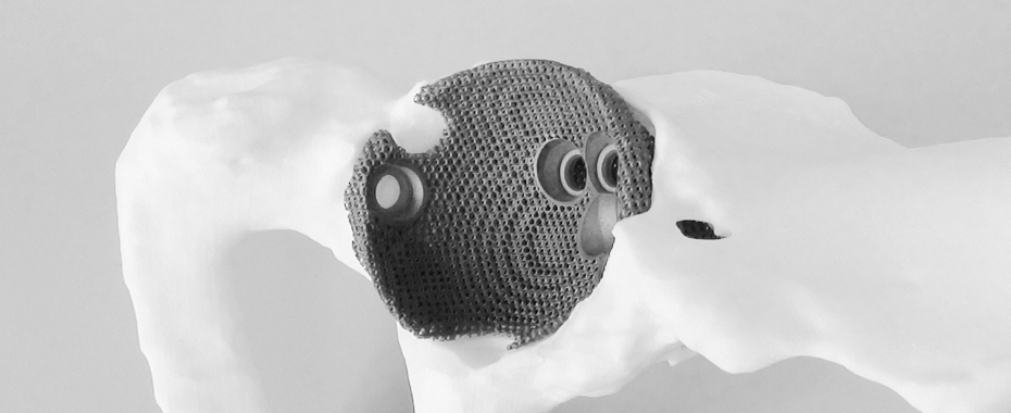 materialise-3d-printing-surgery-cases