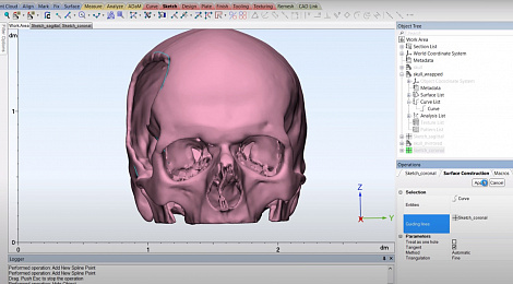 materialise-mimics-implant-tavr