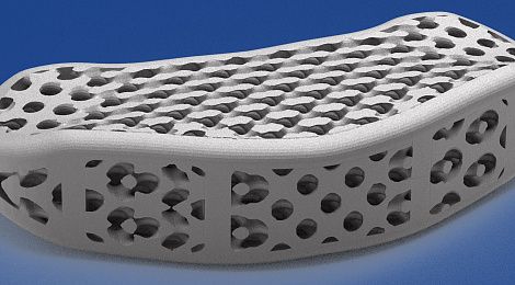 hbd-orthodedic-implants